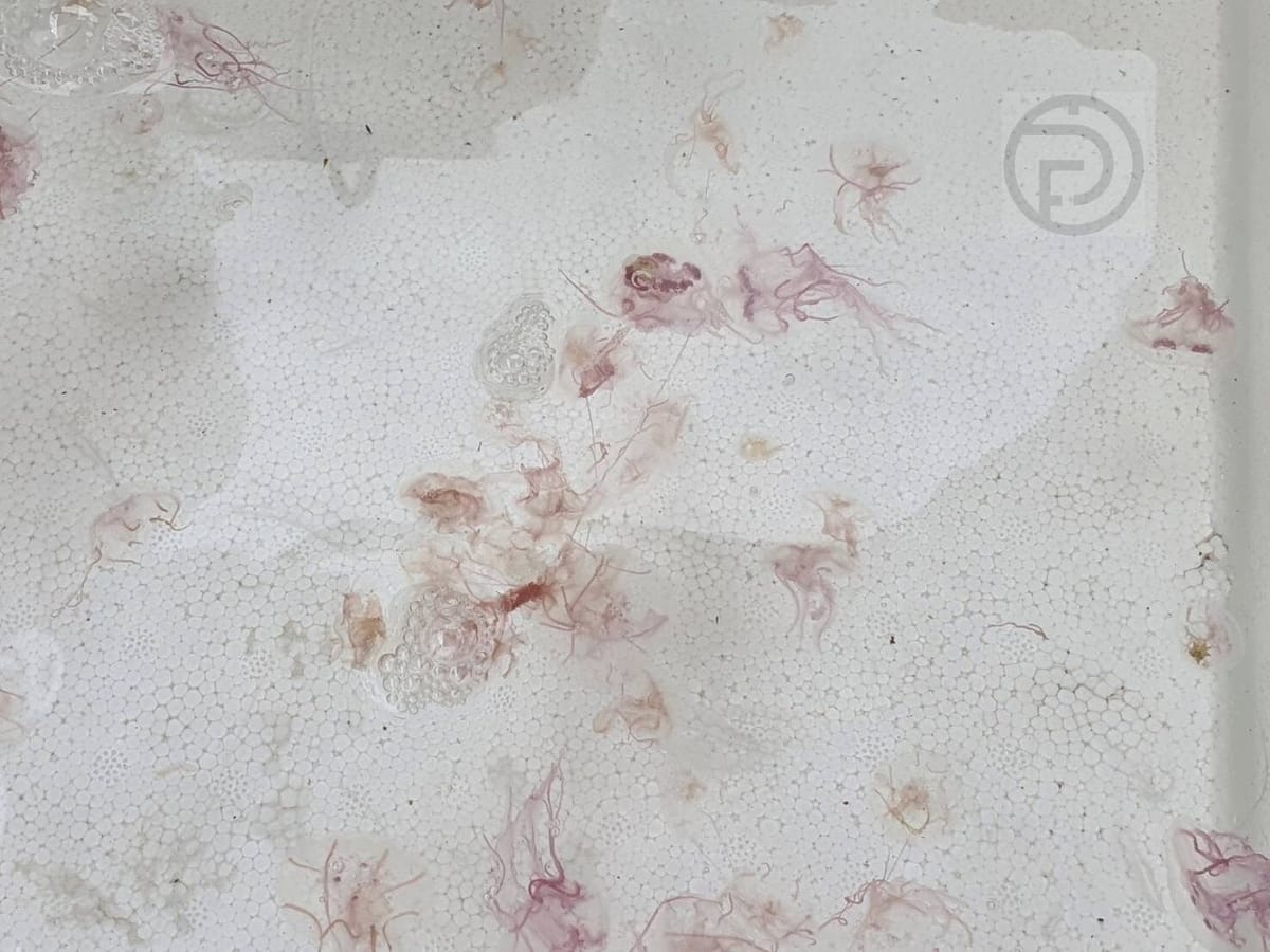 Venomous Jellyfish Warnings Off of Phuket