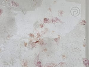 Venomous Jellyfish Warnings Off of Phuket