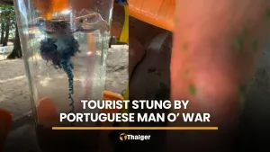 Tourist hospitalised after Portuguese man o’ war sting at Phuket beach