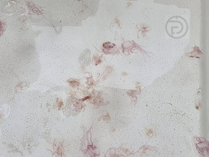 Venomous Jellyfish Warnings Off of Phuket