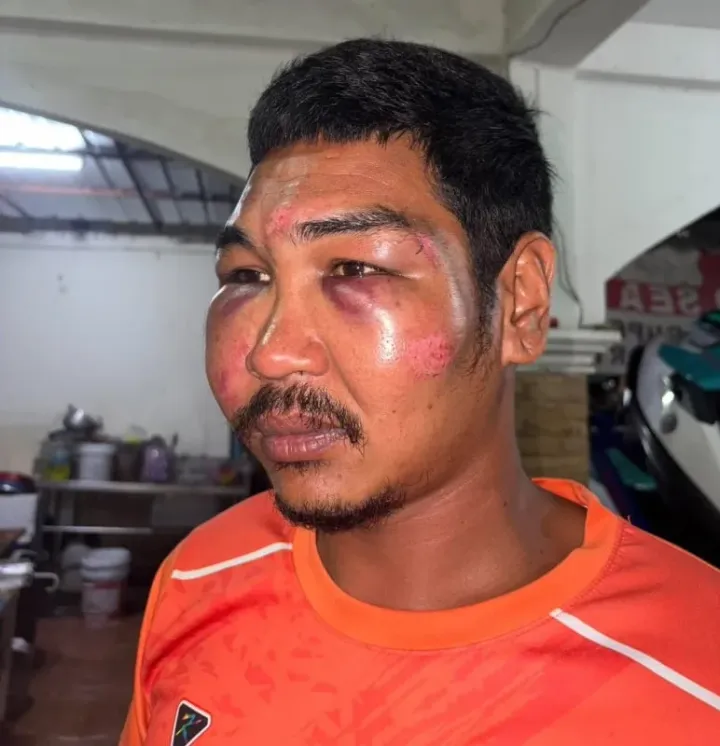 Patong Police investigate jet-ski operator assault complaint involving American tourist